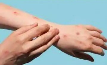 Generic placeholder image